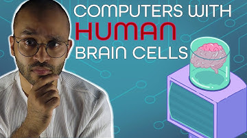 Scientists connected brains to computers. Is this the future of AI?