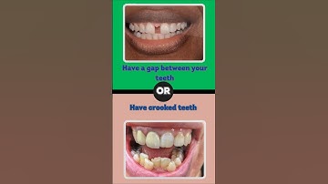 🔥 Would You Rather? The TOUGHEST Choices Ever! 🤯 #Shorts  #youtubeshorts #quiz #wouldyourather