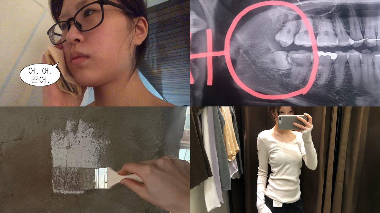 쇼핑하고 사랑니뽑고 아파하는중..