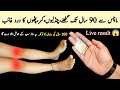 You will not have knee pain for 90 years with just remedy of Match sticks | knees pain | joints pain