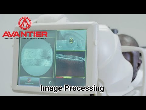 Image Analysis & Processing at Avantier
