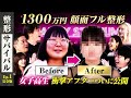 【完結編】1300万円顔面フル整形 女子高生 衝撃アフターついに公開！！藤森＆ひろゆき＆宮迫も仰天！【整形サバイバル#1】