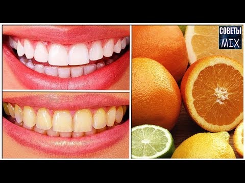 Простые секреты здоровой и белоснежной улыбки. Продукты, которые портят ваши зубы
