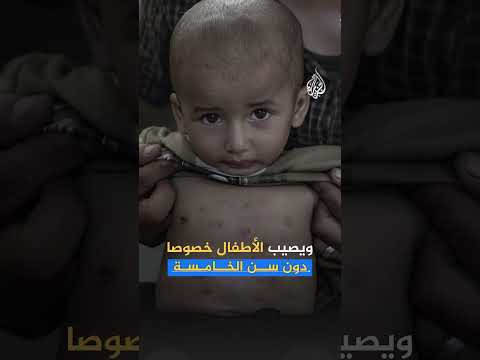 مياه غزة تتحول من شريان للحياة إلى خطر يهدد حياة المدنيين.. ما التفاصيل؟