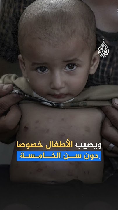           ..  
 - نشر قبل 7 دقيقة