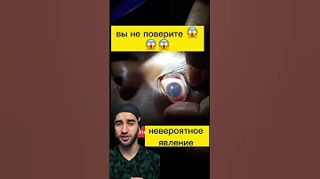 что? черви в глазу?