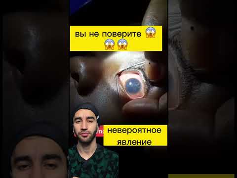 Видео: Почему черви слепы?