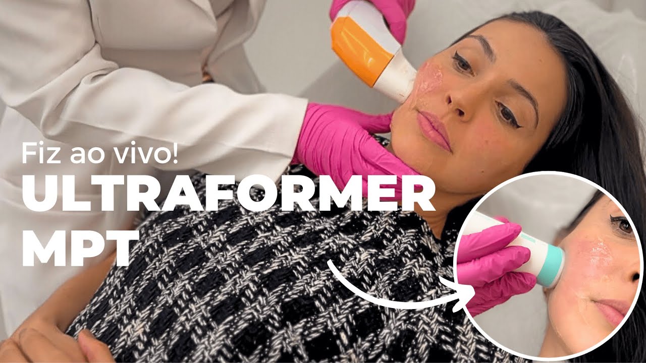 FIZ O ULTRAFORMER MPT!! EXPLICANDO COMO O TRATAMENTO FUNCIONA - YouTube
