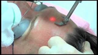 Sciton - Profractional Therapy
