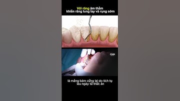 Lý do tại sao phải cạo vô răng #nhakhoa #nhasi #caovoirang