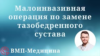 Малоинвазивная операция по замене тазобедренного сустава | ВМП-Медицина