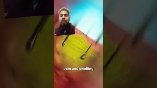 How Scorpions Sting You 😨 (Yikes!) | Nature’s Tiny Assassin #shorts