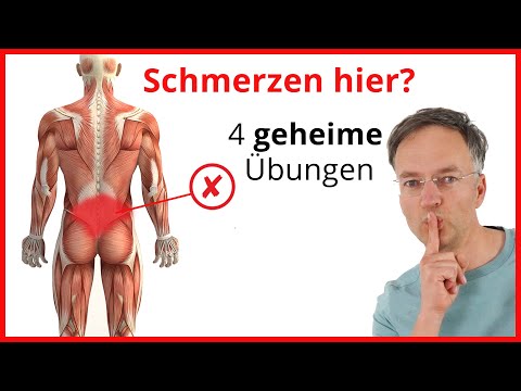 Rückenschmerzen UNTERER RÜCKEN