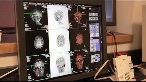 Show Me Where It Hurts: Visualizing Chronic Pain