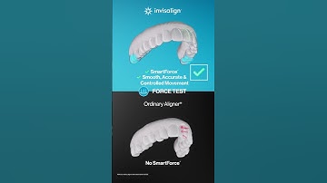 Tried, tested, and trusted aligners from Invisalign
