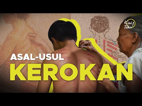 Kerokan, Tradisi Turun-temurun Indonesia untuk Atasi Masuk Angin — Video GNFI