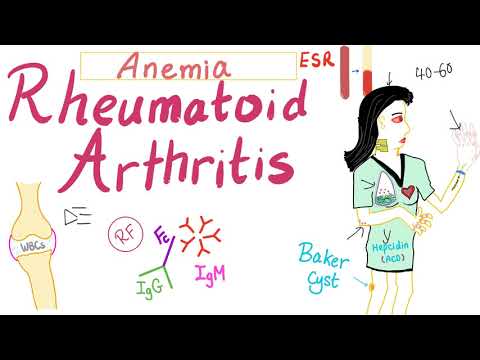 Video: Rheumatoid Arthritis Dan Anemia: Adakah Mereka Terhubung?