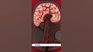 WTF is brain freeze??