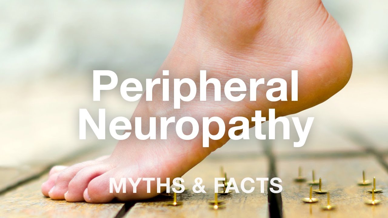 Peripheral Neuropathy Myths & Facts | El Paso, TX (2019)