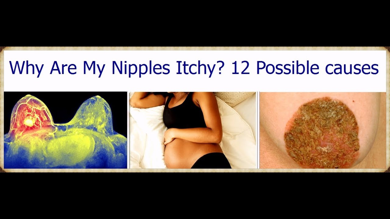 What Does It Mean When Your Nipples Itch