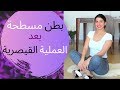 بطن مسطحة بعد العملية القيصرية 💃