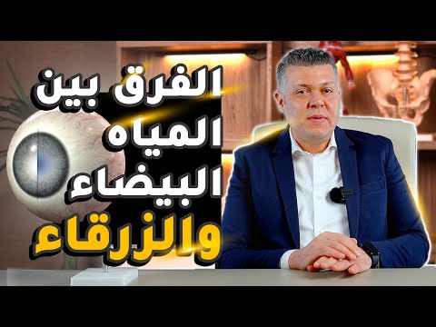 الفرق بين المياه البيضاء والزرقاء في العين