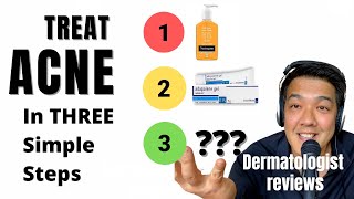 ACNE TREATMENTS | SIMPLIFIED By Dermatologist
