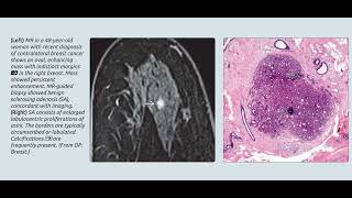 breast imaging(4)