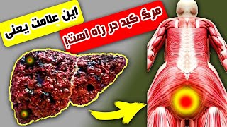 ده نشانه که کبد شما در حال مرگ است! 90 درصد مردم در موردش نمی دانند ...