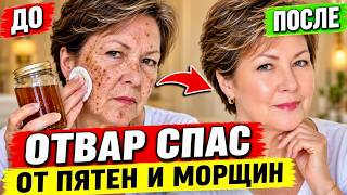 Я не поверила... но ЭТОТ ОТВАР УБРАЛ ПЯТНА и МОРЩИНЫ ! Мой лучший способ омоложения за 5 минут