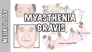 Myasthenia Gravis  symptoms, pathophysiology, investigations, treatment