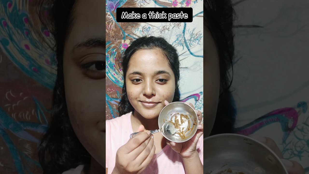 Overnight Acne Treatment😌| Remove Pimple and Acne Overnight #shorts #youtubeshorts #pimple #acne