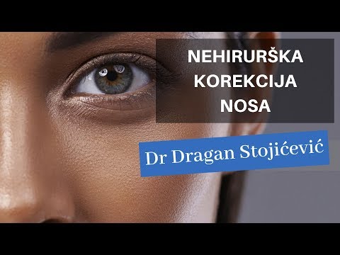 Video: Nehirurška Rinoplastika: Kaj Pričakovati, Stroške, Povračilo In še Več