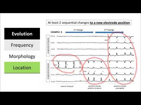 Clinical and Electrographic