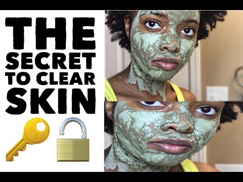 HOW TO Get Rid of Acne and Fade Dark Marks | Worlds Most Powerful Face Mask