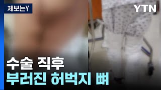 [제보는Y] 고관절 수술 직후 부러진 허벅지 뼈...병원 ´뼈가 약해서´ / YTN