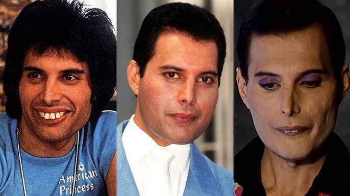 Freddie Mercury And AIDS - The Heartbreaking Story - YouTube