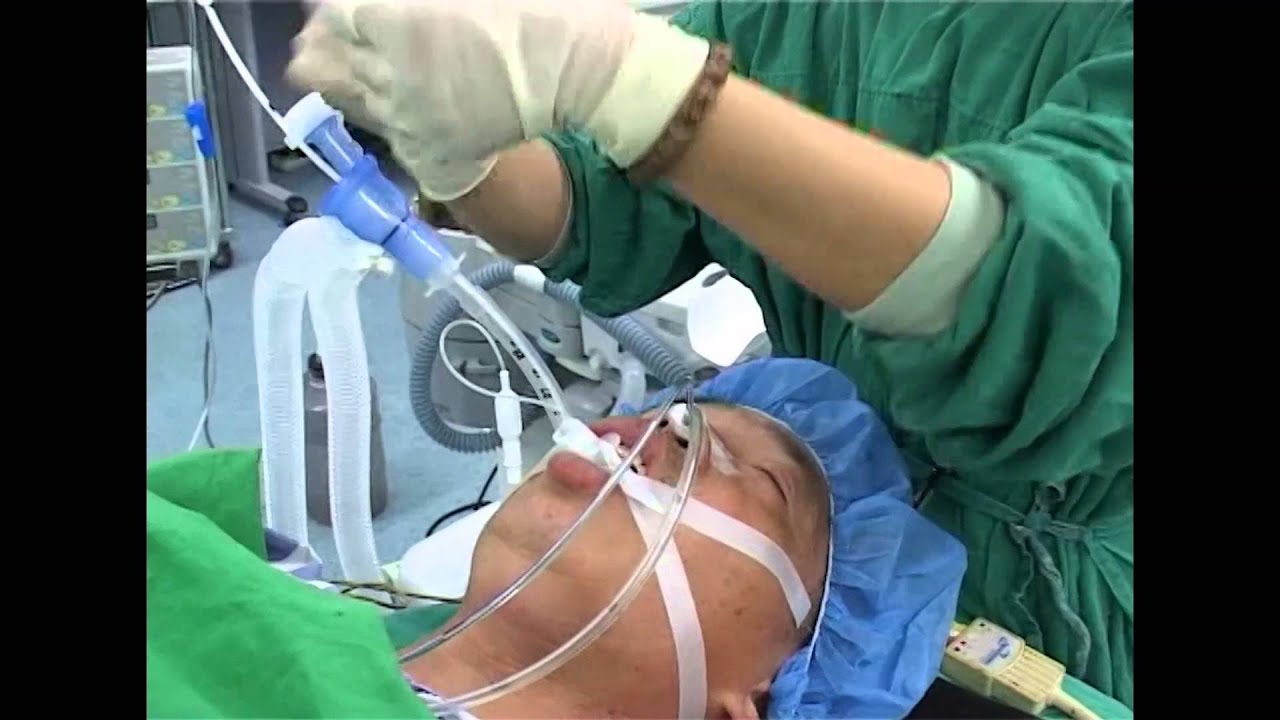 Disposable endobronchial blocker tube YouTube