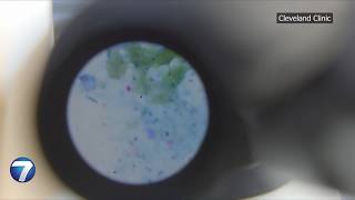 Are Cyclospora cases increasing or decreasing in Ohio? | WHIO-TV