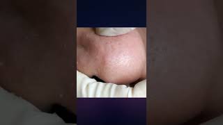 Relax Every Day With Hhv Clinic