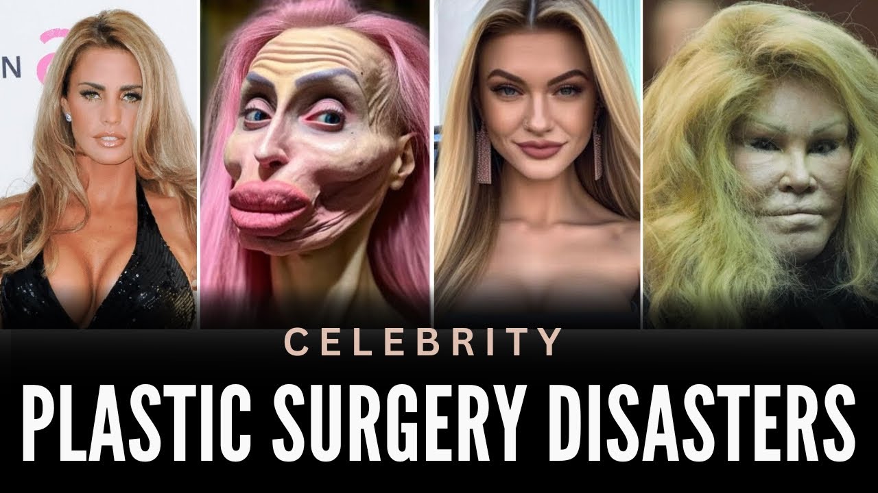 Top 5 Celebrity Plastic Surgery Diasters | You’d Never Recognize Today