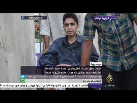 من سوريا.. محمد طفل أصيب بشلل رباعي نتيجة قصف الغوطة الشرقية بريف دمشق