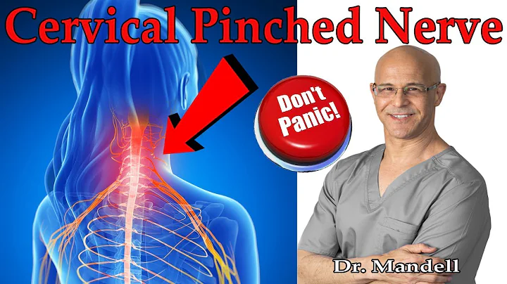 How to Overcome Cervical Pinched Nerve & Radiculopathy (Don't Panic) - Dr. Alan Mandell, DC