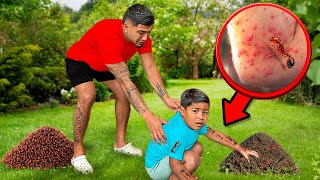 Zakyius Got STUNG By FIRE Ants!