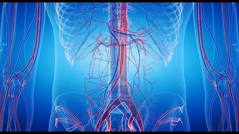 Recent Advancements in Role of Endovascular Revascularization Procedures in Chronic Limb Ischemia