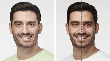 ¿Cómo se ve la asimetría facial?