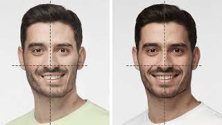 Asimetría facial: Qué es, tipos y tratamientos.