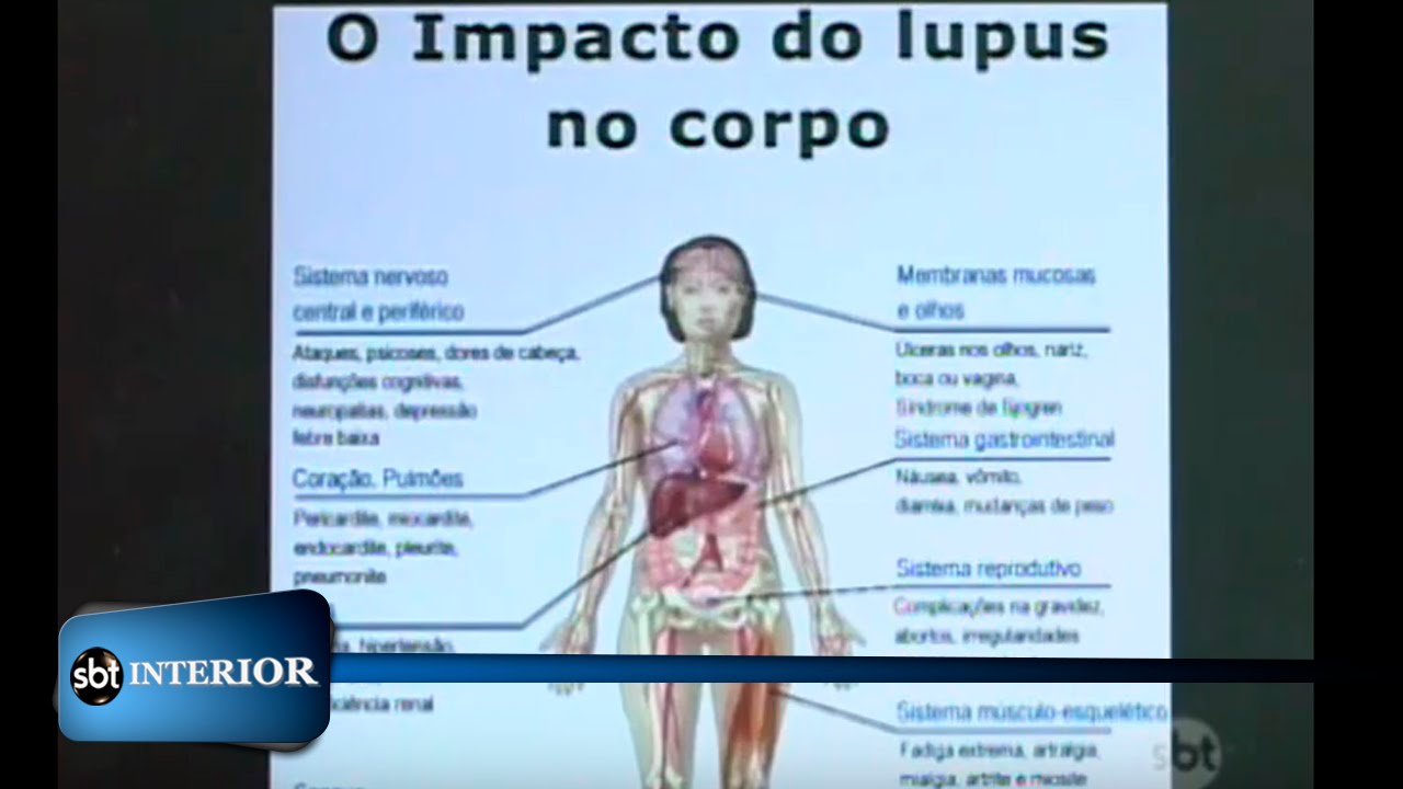 lupus cura)