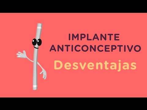 Vídeo: Implante Anticonceptivo: Efectos, Beneficios Y Desventajas
