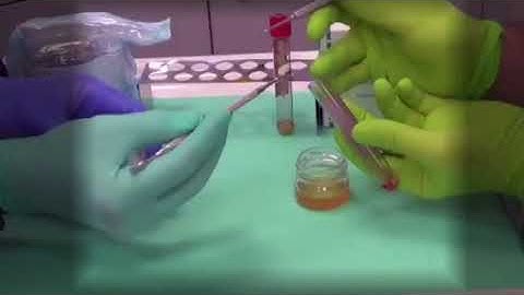 Wondering how we use an extracted tooth as an injectable paste? Lector conf. dr. Leretter marius